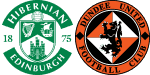 Hibernian x Dundee United
