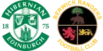 Hibernian x Berwick