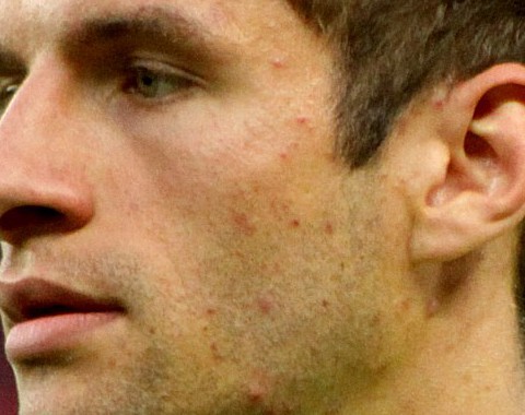 Thomas Müller para marcar no França vs Alemanha